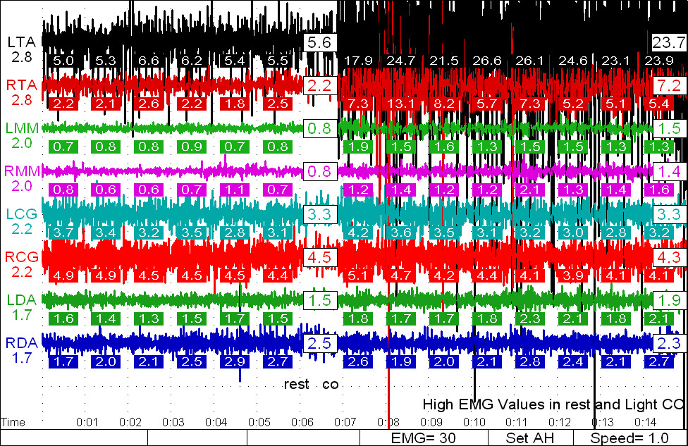 A colorful graph displaying numeric data.