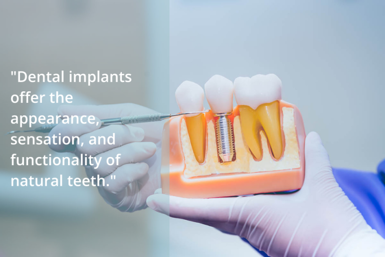 Exploring the Benefits of Dental Implants for Tooth Replacement