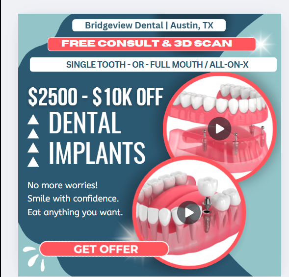Dental implant advertisement showing price range of $2500-$10,000 off, with images of dental models and text offering free consult and 3D scan at Bridgeview Dental in Austin, TX.