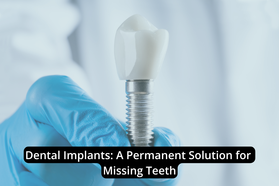 A gloved hand holds a dental implant, a permanent solution for missing teeth, featuring a metal screw and a white artificial tooth against a blurred background.